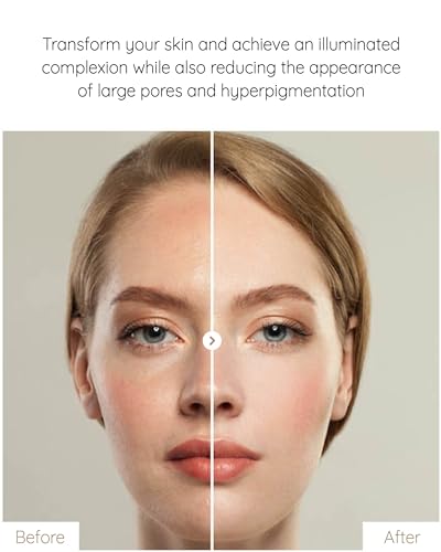 MASTINA White Mastic Ampoule Sheet Mask Pack of 12- Illuminating. Ultra-Moisturizing Facial Mask. Intensive Korean Skin Care. Fermented Mastic Gum