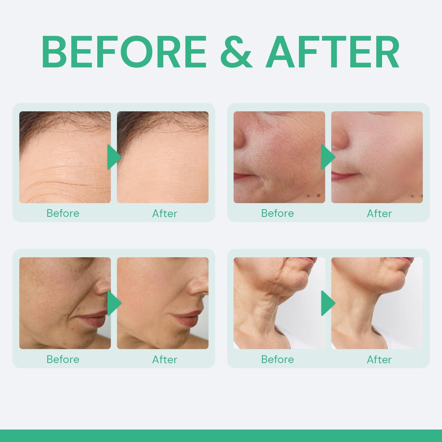 Retinol Moisturizer Face Cream Anti-Wrinkles: Anti Aging Collagen Day & Night Cream for Dry Skin - Daily Moisturizing Cream for Women & Men, Neck Wrinkles Reducer With Hyaluronic Acid and Niacinamide