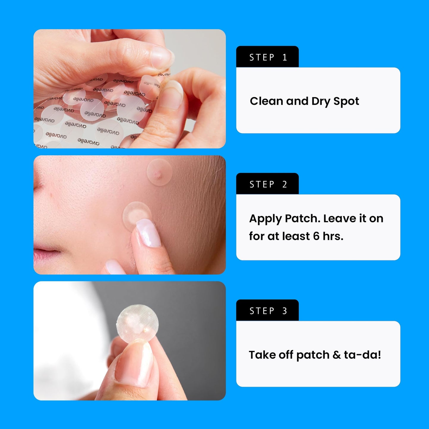 AVARELLE Pimple Patches for Face | Hydrocolloid Acne Patches for Covering Blemishes | FSA HSA Zit Patches with Tea Tree, Calendula, & Cica | HSA Store Eligible Items (10-14 mm, 80 Count)