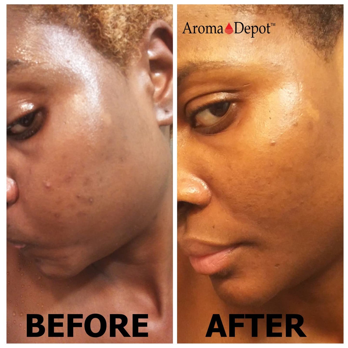 Aroma Depot 16 oz /1 lb Raw African Liquid Black Soap 100% Natural soap for Acne, Eczema, Psoriasis, and Dry Skin Scar Removal Face And Body Wash. Handmade imported from Ghana